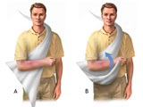 glossary-AEROBAND-Calico-Triangular-Bandages--howto